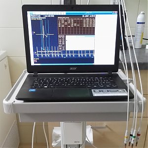Elektokardiografický (EKG) prístroj
